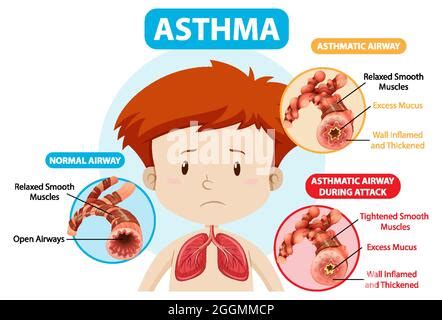 ashema letube|A. Shema .